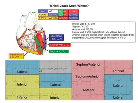 12 lead ecg interpretation chart.
